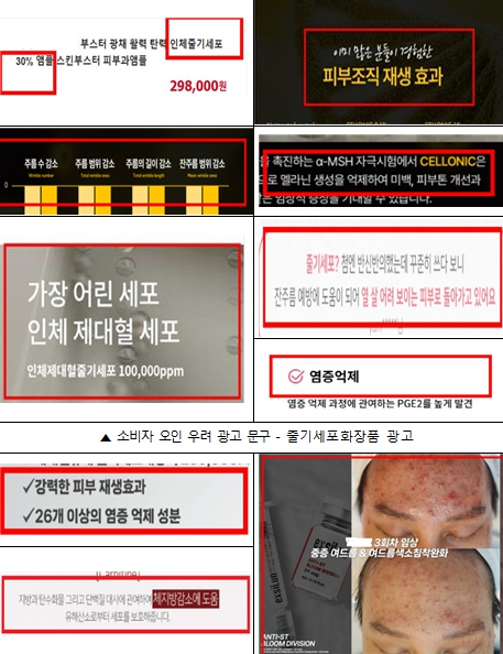 부산시 특사경, '피부재생' 줄기세포 화장품 등 온라인 부당광고 업체 11곳 적발